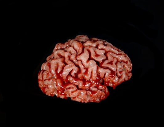 BP- Large Brain