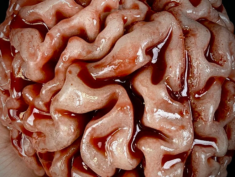BP- Large Brain