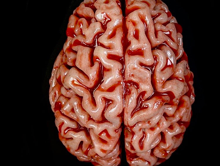 BP- Large Brain