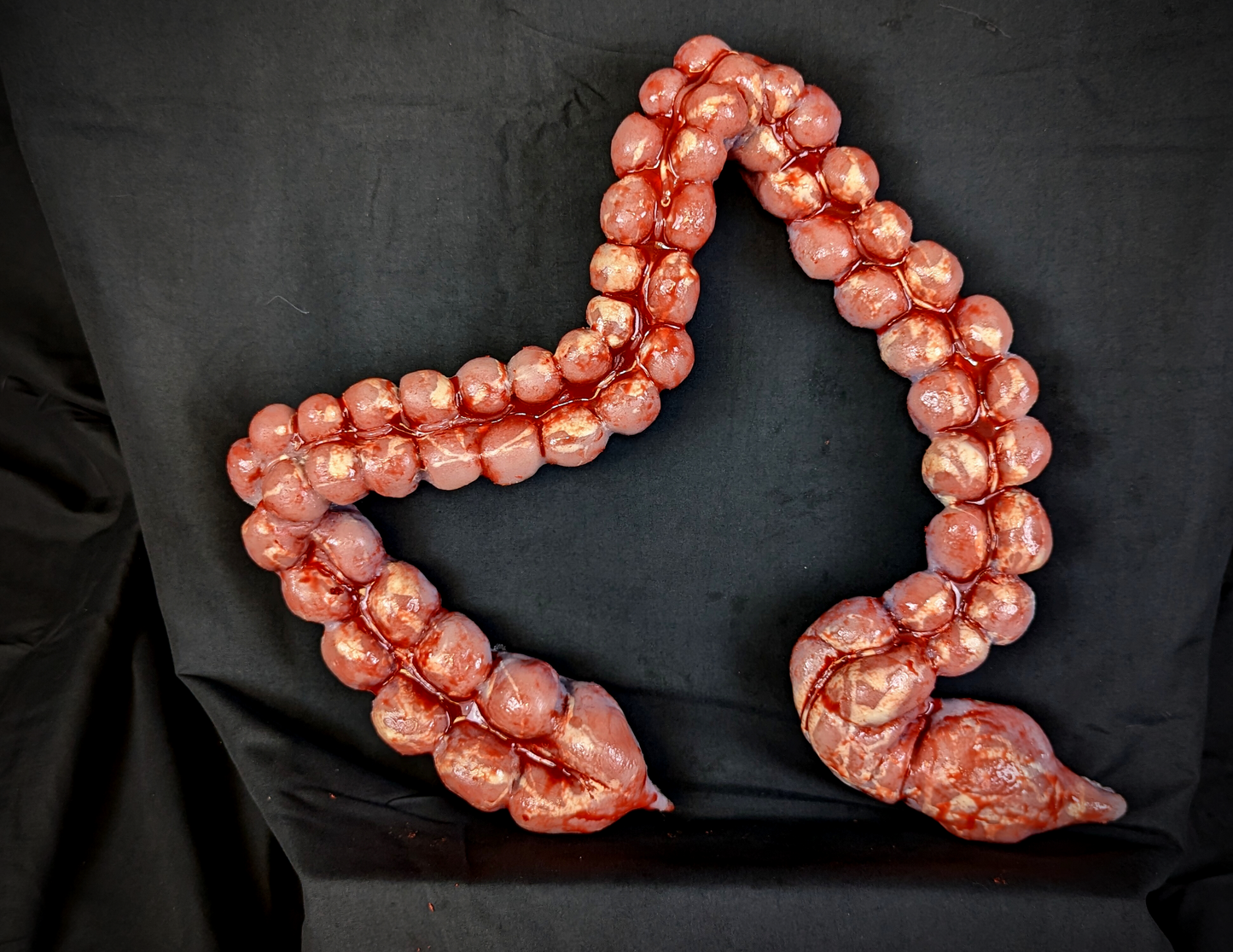 BP- Large Intestine