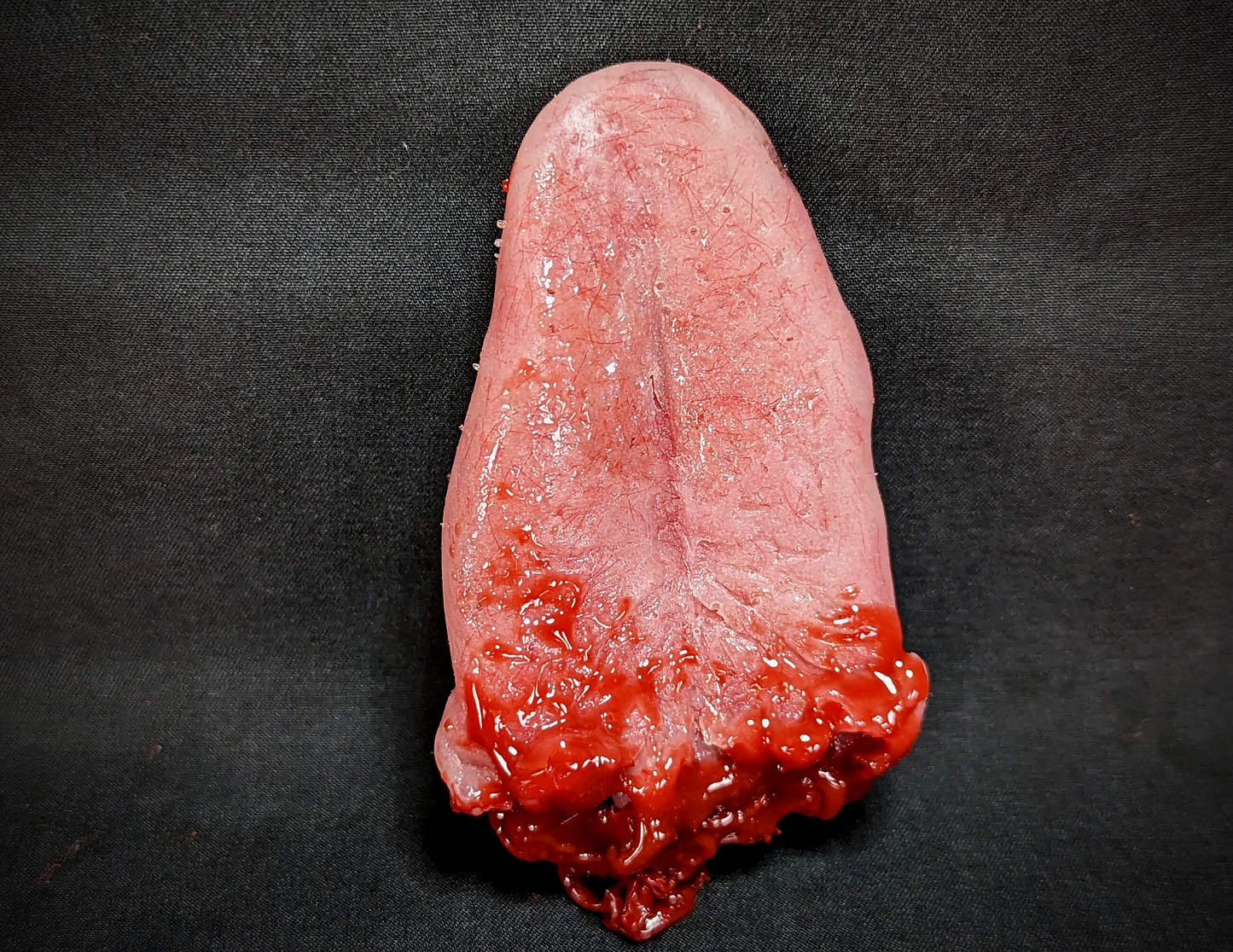 BP- Tongues