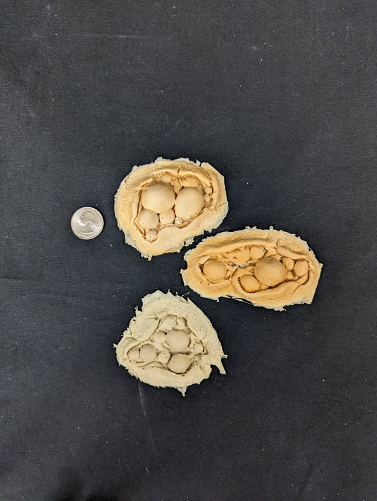 Prosthetics- Wound/Boils